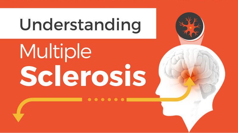 Understanding MS Infographic